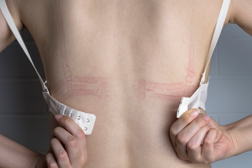 Jak rozpoznać, że nosisz zły rozmiar biustonosza? 10 alarmujących sygnałów